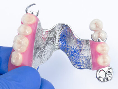 When Should You Consider Partial Dentures for Back Teeth on One Side?