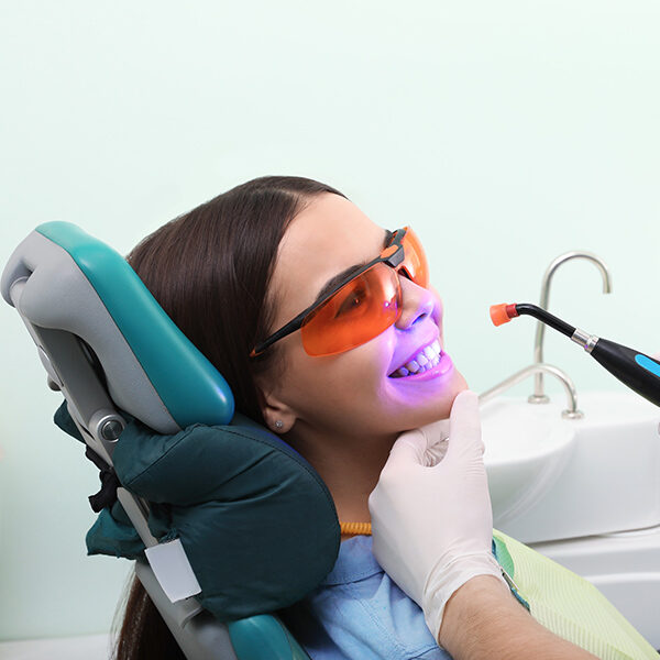 Dental-Bonding