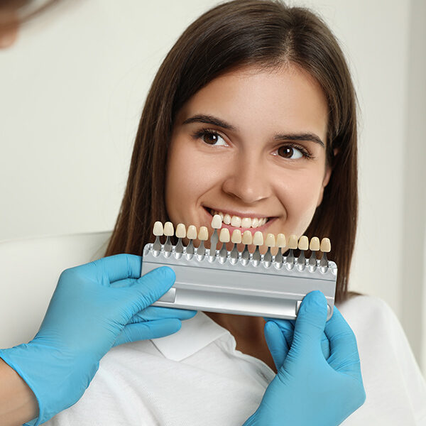 Porcelain-Veneers
